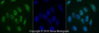 PC12 Cells Stained Using Conjugated 53BP1 Antibody